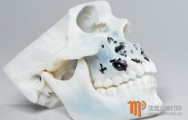 3d打印下颚骨模型